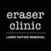 Eraser Clinic Laser Tattoo Removal